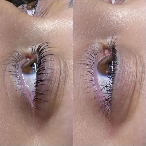 Antes e depois dos cílios